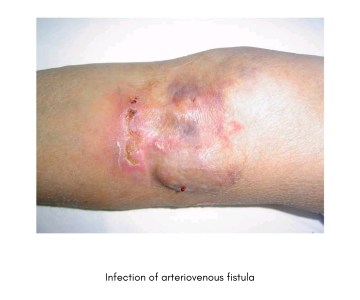 Screenshot_20190305-221130__01