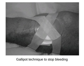 Screenshot_20190312-194654__01