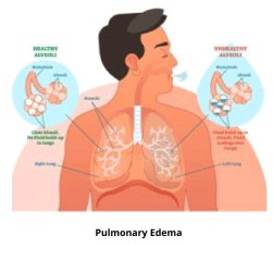 Screenshot_20200413-234428__01